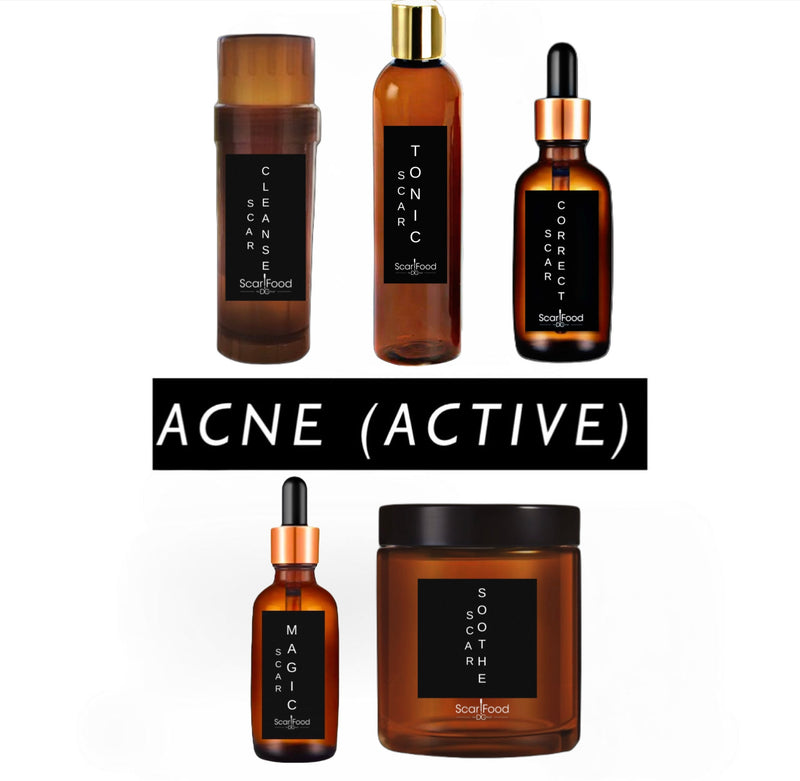 Active Acne Kit