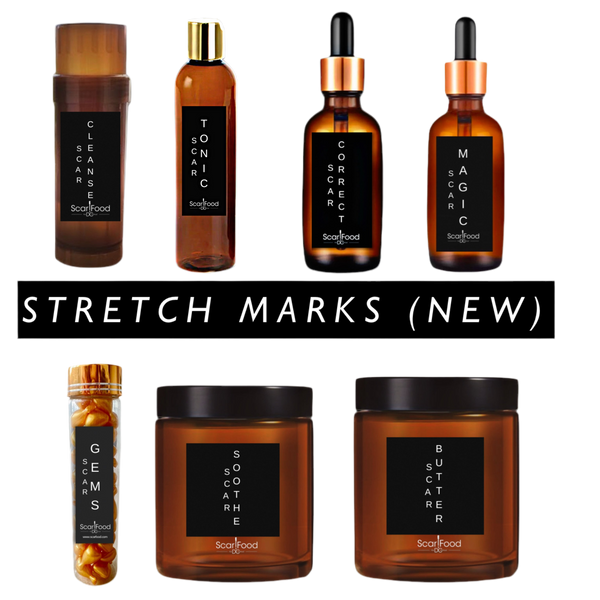 SALE! Stretch Marks - Scar Food