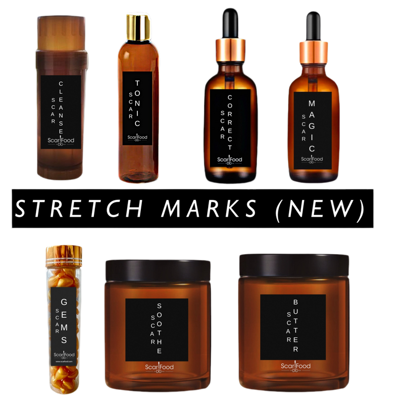 Stretch Marks (New)