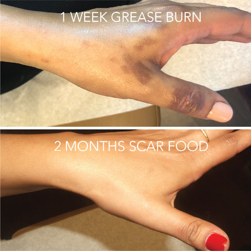 Scar Gems (Dramatically Decreases Wound Healing Time) Scar Food